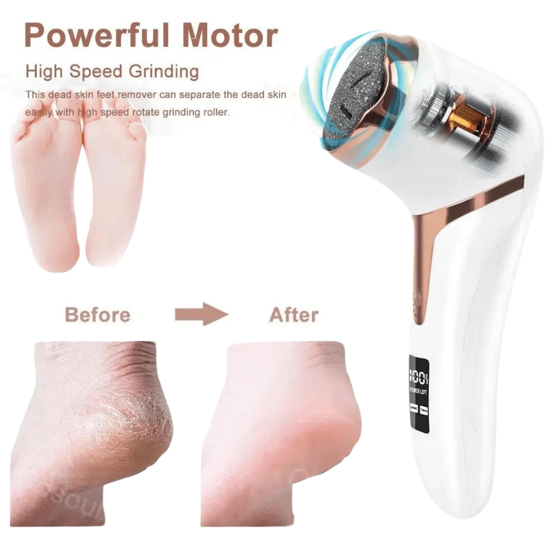 Pampered Feet in Minutes: Cushy Footsie™ Professional Electric Foot File